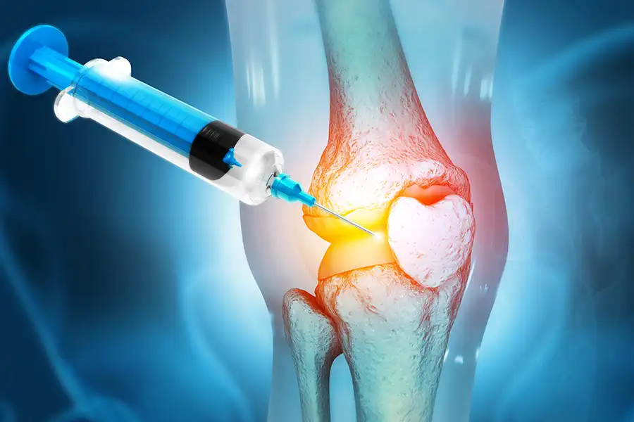 Simply Direct Medicine of Farmers Branch, TX —A graphic of PRP Therapy treatment into a kneecap.